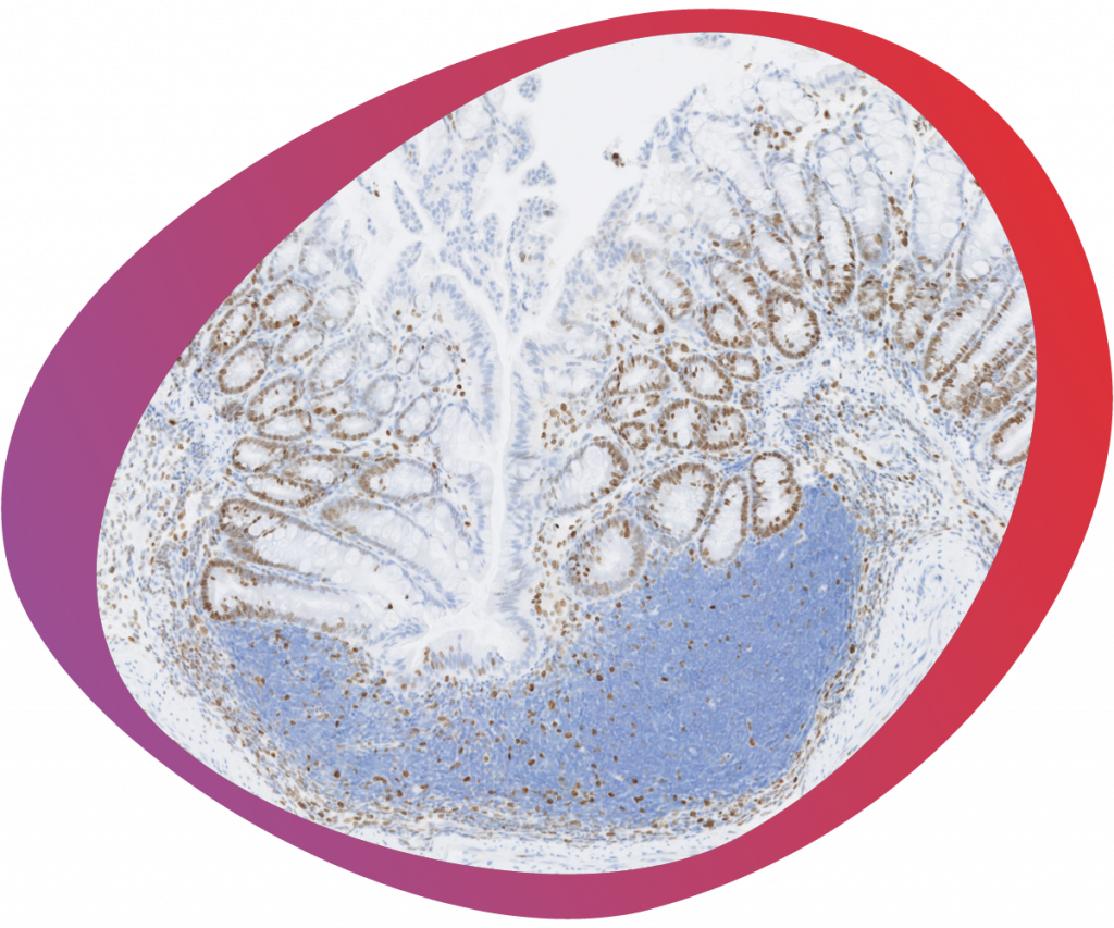 HistologiX Immuno-oncology service