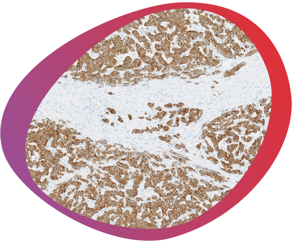 Close-up view of an Immunohistochemistry (IHC) stain, highlighting intricate tissue structures, demonstrating the specificity and detail achievable with IHC in scientific research